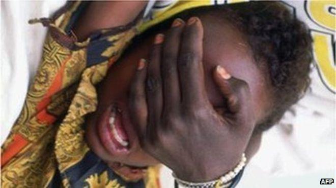 FGM
