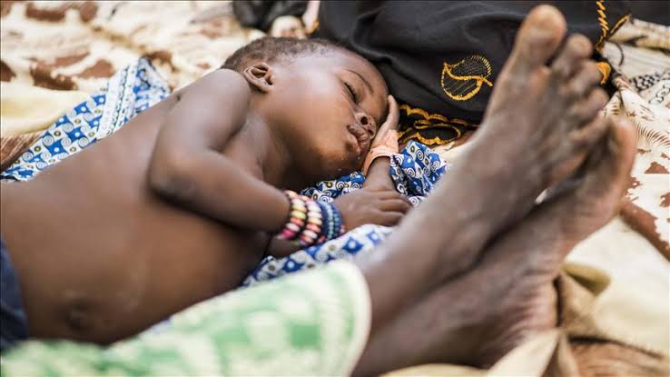child malnutrition