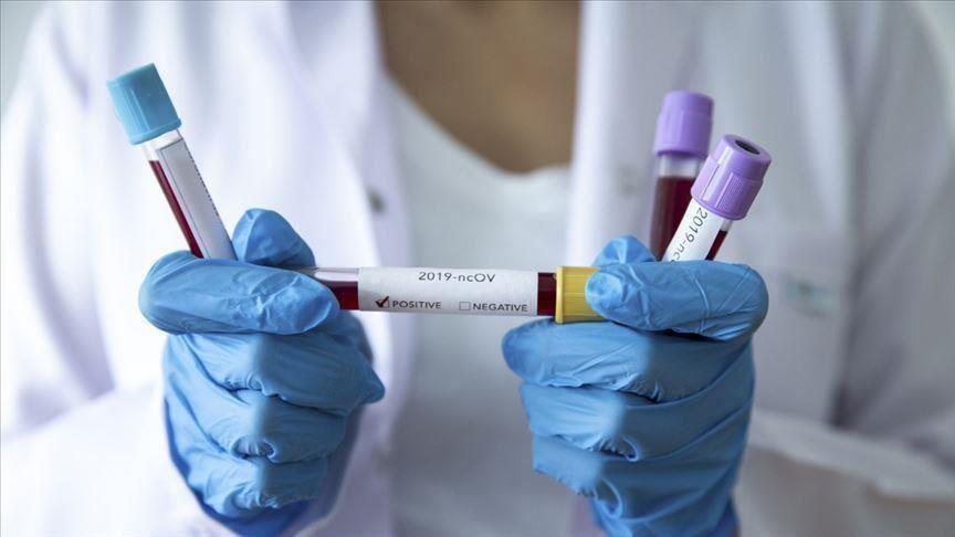 Lagos tests 25 people per day for coronavirus, says Committee chairman