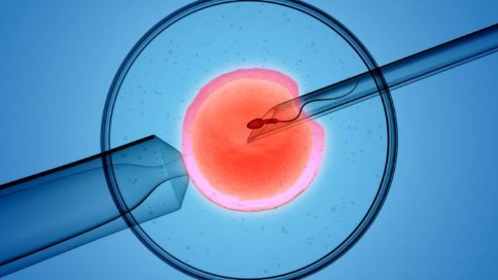 IVF