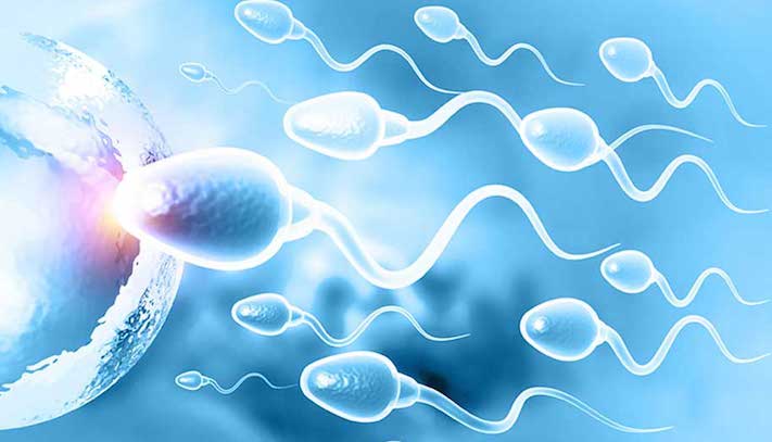 Infertility in men