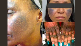 Deadly Trade (I):  Fair skin at the cost of people’s health