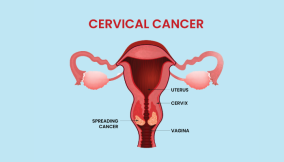 Kwara: Community pharmacists screen 100 women to detect breast, cervical cancer