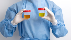 Fermented urine (Jenkem): The disturbing drug trend that spread from Zambia to Maiduguri