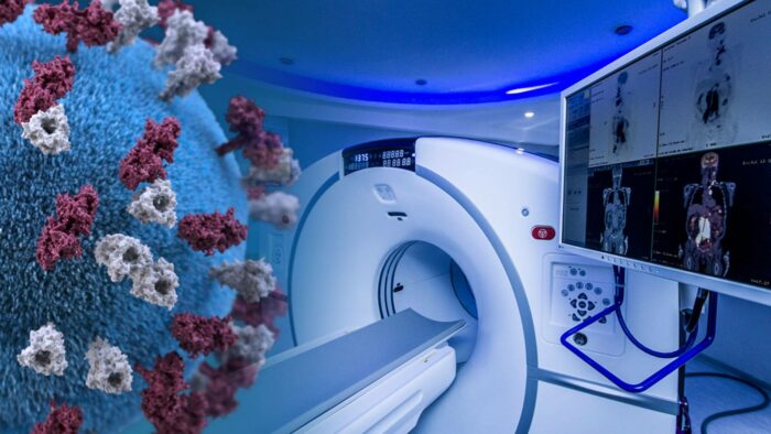 MRI Scan