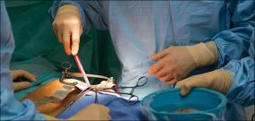 Pig organ recipient thrives after record 2 months