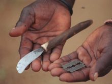 Female genital mutilation