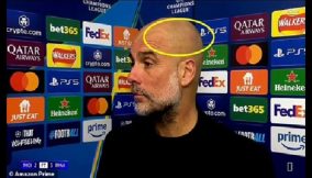 Guardiola=scratches