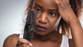 5 natural remedies for hair loss