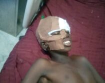 Abuja accident victim