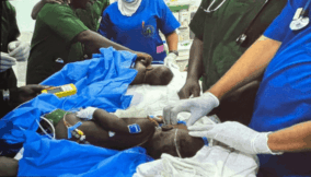 Modibbo Adamu University seperates conjoined twin in free life-saving surgery