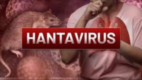 Hantavirus