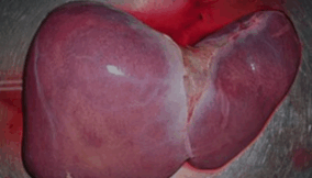 Medical experts raise alarm over dangers of self-medication on liver health