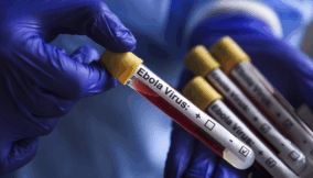 Oyo govt assures residents of safety amid Ebola concerns